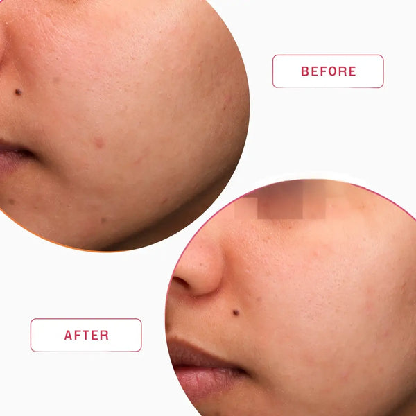 Smartker Professional Equilibrium