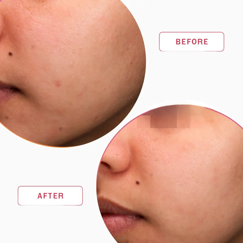 Smartker Professional Equilibrium