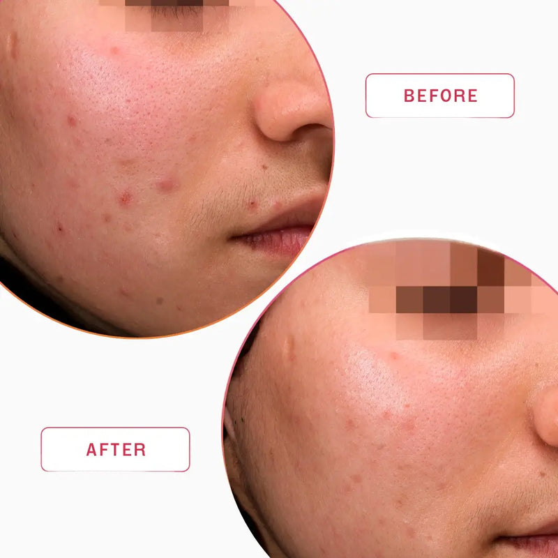 Smartker Professional Equilibrium