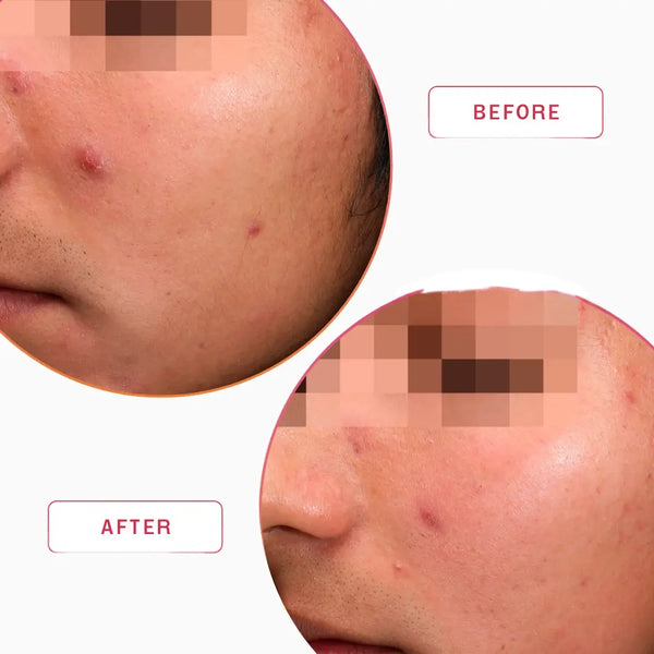 Smartker Professional Multivit