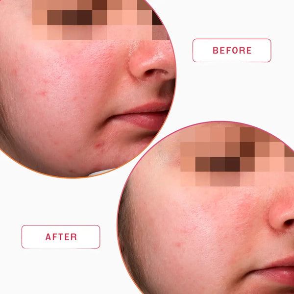 Smartker Daily Multivit