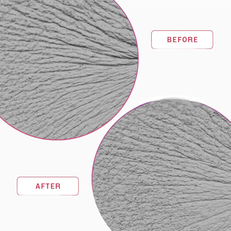 Smartker Professional Hyaluronic