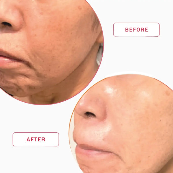 Smartker Daily Extreme Firmness