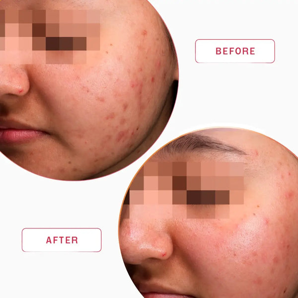 Smartker Daily Radiant